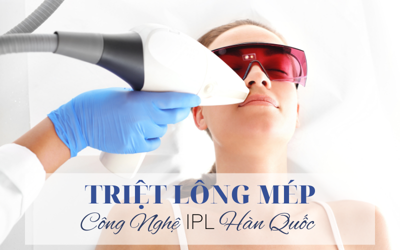 Triệt lông mép